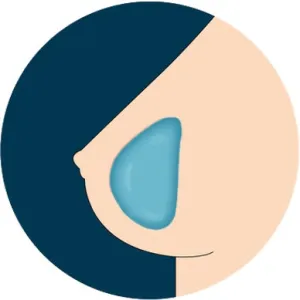 HR  Breast Option - Gel Breasts